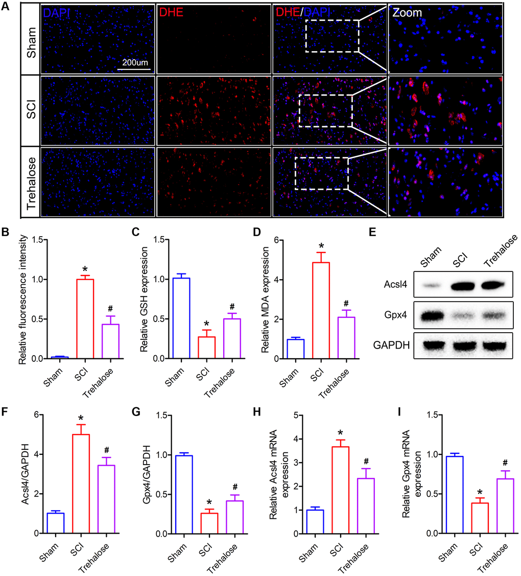 Trehalose inhibits the production of ROS and lipid peroxides after SCI. (A, B) DHE staining of spinal cord tissue on day 3 after SCI and fluorescence quantitative analysis; (C) GSH measurement; (D) MDA measurement; (E–G) Western blot to detect the expression of Acsl4 and Gpx4 protein and quantitative protein analysis; (H, I) PCR to measure the expression of Acsl4 mRNA and Gpx4 mRNA. *p #p 