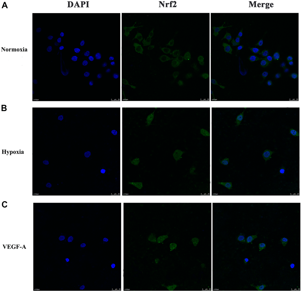 Subcellular localization of Nrf2 in GC cells. (A) Normoxia (B) Hypoxia (C) VEGF-A (×1000).