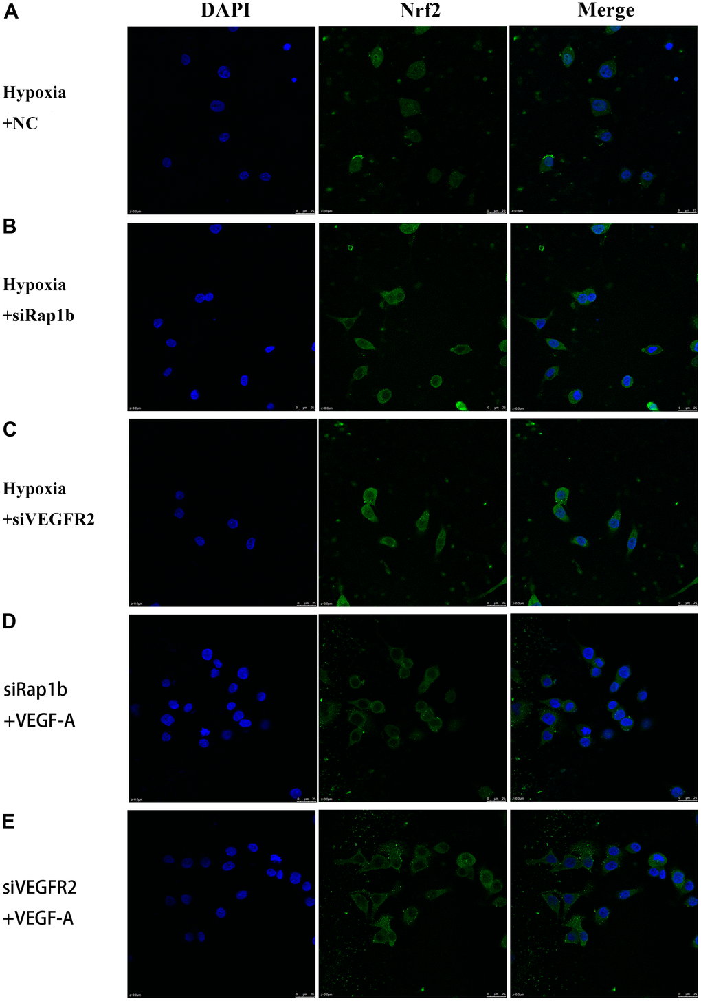 Subcellular localization of Nrf2 in GC cells. (A) Hypoxia and negative control. (B) Hypoxia and siRap1b. (C) Hypoxia and siVEGFR2. (D) siRap1b and VEGF-A. (E) siVEGFR2 and VEGF-A (×400).