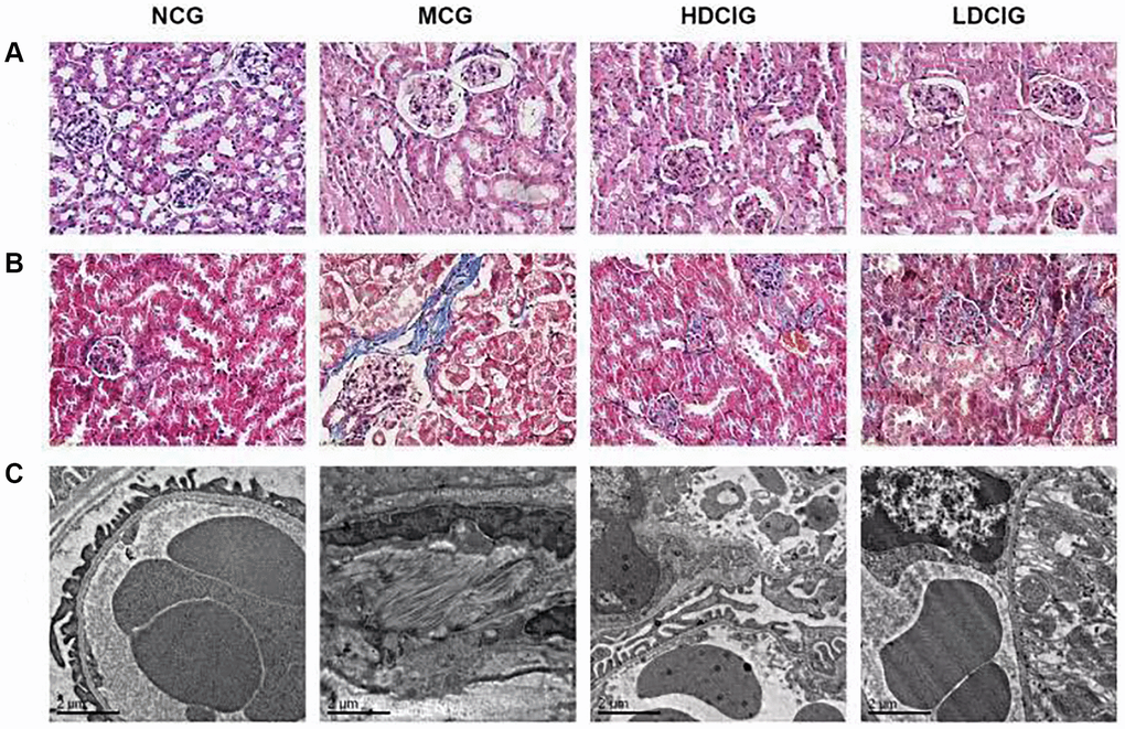 Morphological structure of kidney tissues in db/db mice. (A) HE staining; (B) Masson staining; (C) Electronic microscopy.