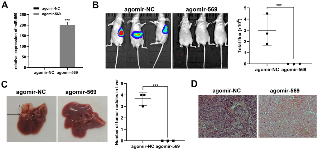 miR-569 inhibited PC cell metastasis in vivo. (A) RT-qPCR showed miRNA agomir transfection efficiency. (B) In vivo bioluminescence imaging of representative animals from each treatment group 10 weeks after tumor cell inoculation. (C) Representative images of the liver of nude mice. Black arrows show metastatic tumor colonies in the liver. (D) HE staining of metastatic tumor colonies in the liver, magnification ×100. (* p  0.05, ** p  0.01, n = 5, Student’s t-test, means ± 95% CI).