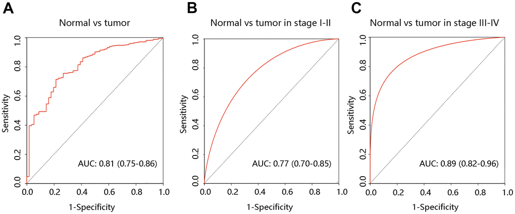 Diagnostic value of F12 in PTC. The ROC curves of F12 expression in PTC vs normal tissues (A) and different clinical stages (B, C). PTC, papillary thyroid cancer; ROC, receiver operating characteristic; AUC, the area under the curve.