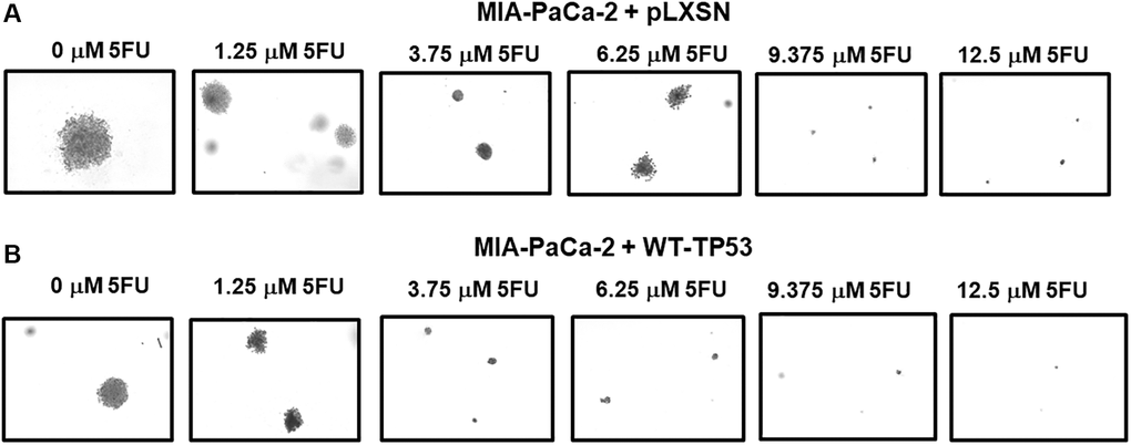 Crystal violet-stained colonies in soft agar in the presence of 5-Fluorouracil. The effects of pLXSN and WT-TP53 on the colony formation in soft agar were photographed after staining. Photographs were taken at the same day and at the same magnification on the microscope. (A) MIA-PaCa-2 + pLXSN cells treated with increasing concentration of 5FU, (B) MIA-PaCa-2 + WT-TP53 cells treated with increasing concentrations of 5FU.