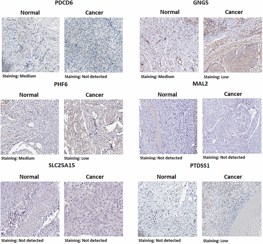 Representative immunohistochemistry images of predicted target genes (PDCD6, GNG5, PHF6, MAL2, SLC25A15 and PTDSS1) in normal urinary bladder tissues and BLCA tissues (Human Protein Atlas).