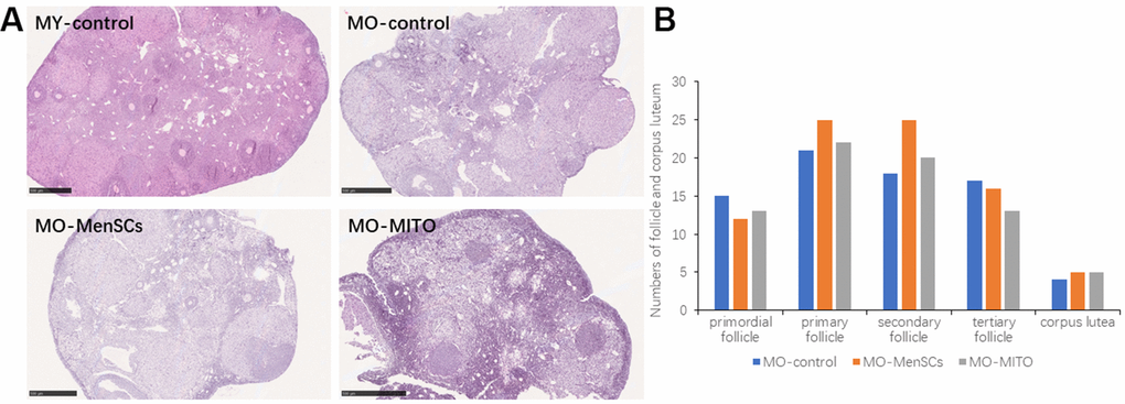 MO-MenSCs and MO-MITO treatment groups showed similar effects on the aged ovary. Representative images showing H&E-stained ovary sections in each group after seven days (A). Bar graph summarizing the number of growing follicles at various stages and corpus lutea in each group (B).
