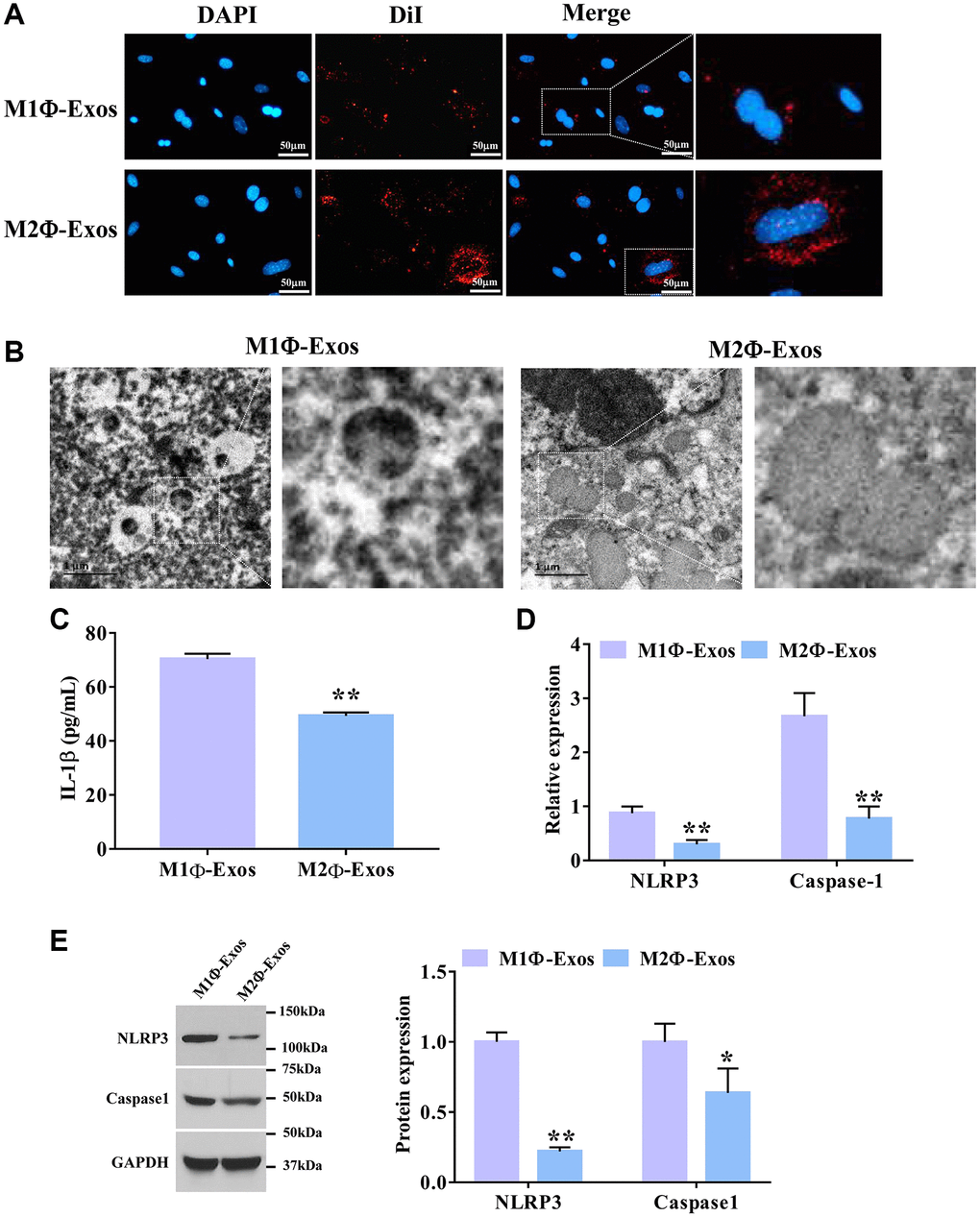 M2Φ-Exos regulate airway epithelial cell pyroptosis. (A) M2Φ-Exos internalization was observed using a laser scanning confocal microscope. Scale bars = 50 μm. (B) The changes of pyroptosis were observed by electron microscope. Scale bars = 1 μm. (C) The expression level of IL-1was detected by ELISA assay. (n = 3) (D) The relative expression levels of NLRP3 and caspase-1 were determined by qPCR. GAPDH was used as an internal control. (n = 3) (E) The protein expression levels of NLRP3 and caspase-1 were determined by Western blotting. *P **P 