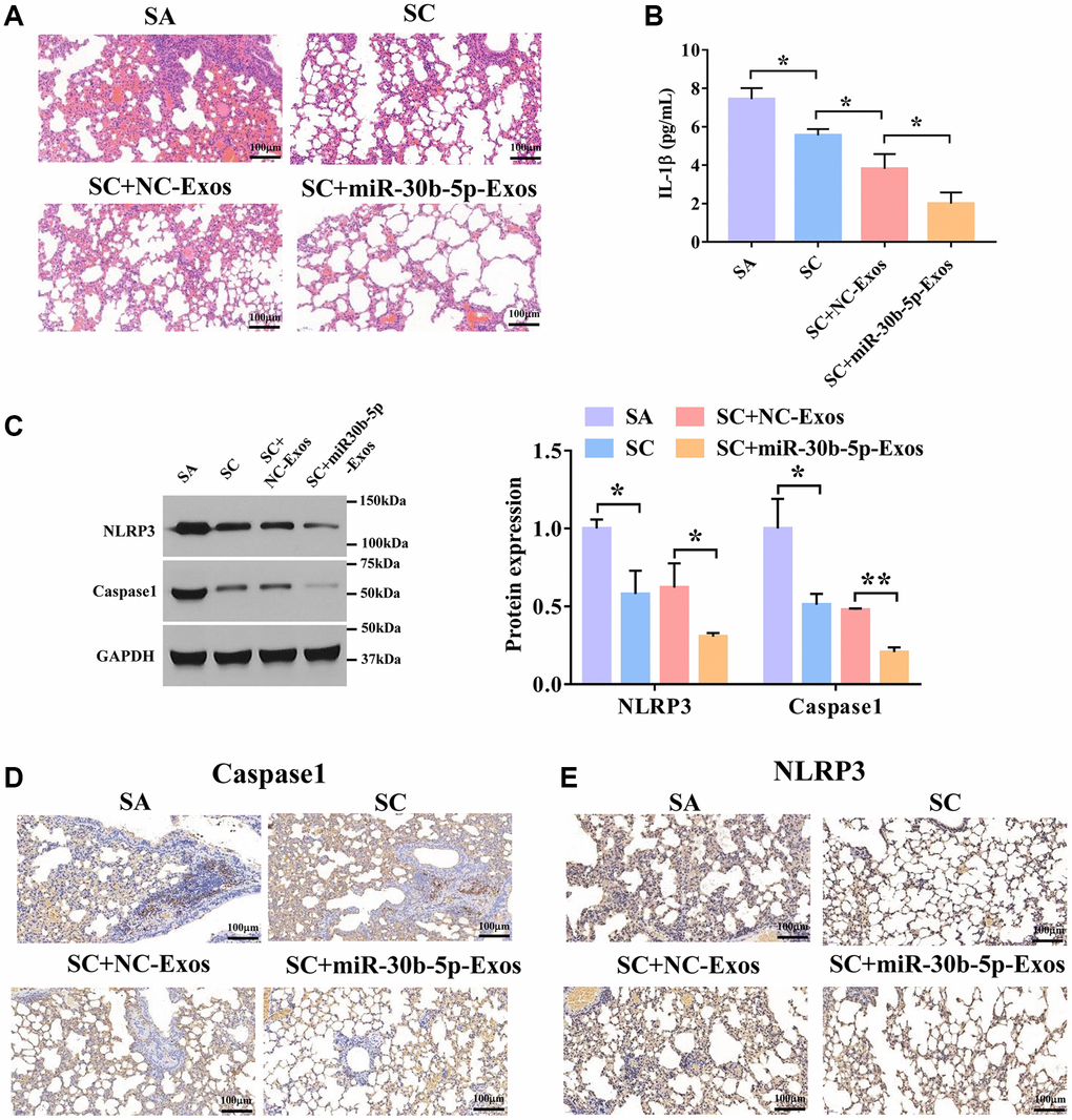 M2Φ-Exos induced by SC carry miR-30b-5p to treat severe asthma. (A) H&E staining of lung tissues in SA model treated with SC and Exos-miR-30b-5p. Scale bars = 100 μm. (B) The expression level of IL-1β in lung tissues was detected by ELISA assay. (n = 3) (C) The expression of NLRP3 and caspase-1 was detected by Western blotting. (D) and (E) The expression levels of caspase-1 and NLRP3 were measured by immunohistochemistry. Scale bars = 100 μm. *P **P 