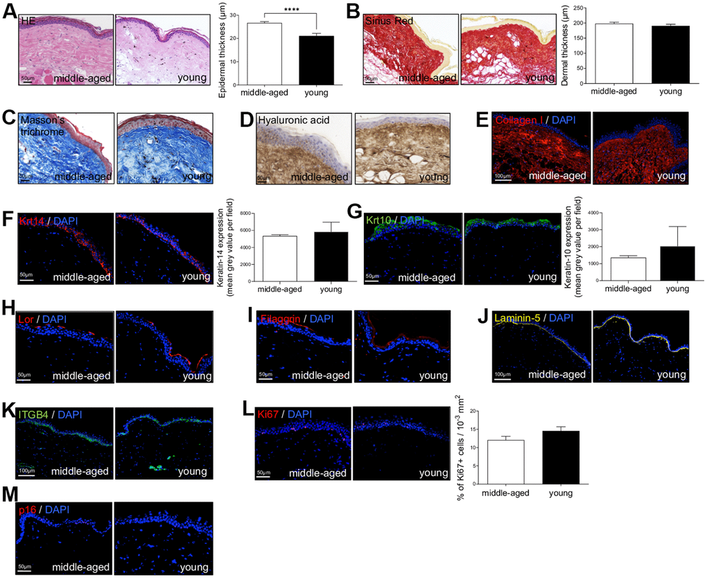 Naked mole-rat (NMR) skin histomorphology. (A–C) HE, Sirius Red and Masson’s Trichrome staining photomicrographs on sections of middle-aged and young NMR back skin. Histograms in A and B show the epidermal and dermal thickness (μm) of middle-aged and young NMR back skin. Scale bar = 50 or 100 μm. Bars: SEM. *represents differences between the age groups. ****p≤0.0001 in Student’s t-test. n=4 animals per group. (D–M) Hyaluronic acid, Collagen I, Keratin-14 (Krt14), Keratin-10 (Krt10), Loricrin (Lor), Filaggrin, Laminin-5, ITGB4, Ki67and p16 staining photomicrographs on sections of middle-aged and young NMR back skin. Cells were stained with either Alexa 546 or Alexa 488 fluorochromes. For hyaluronic acid, cells were stained with 3,3’-diaminobenzidine. Negative controls were performed in parallel with the samples substituting the primary antibody with the equivalent isotype. Histograms show the quantification of Krt14 and Krt10 expressions and Ki67+ cells per surface in both age group. Scale bar = 50 or 100 μm. Bars: SEM. A Mann–Whitney U test was used for Keratin-14 / Keratin-10 quantification and a Student’s t-test was used for Ki67+ cells quantification. n=4 animals per group.