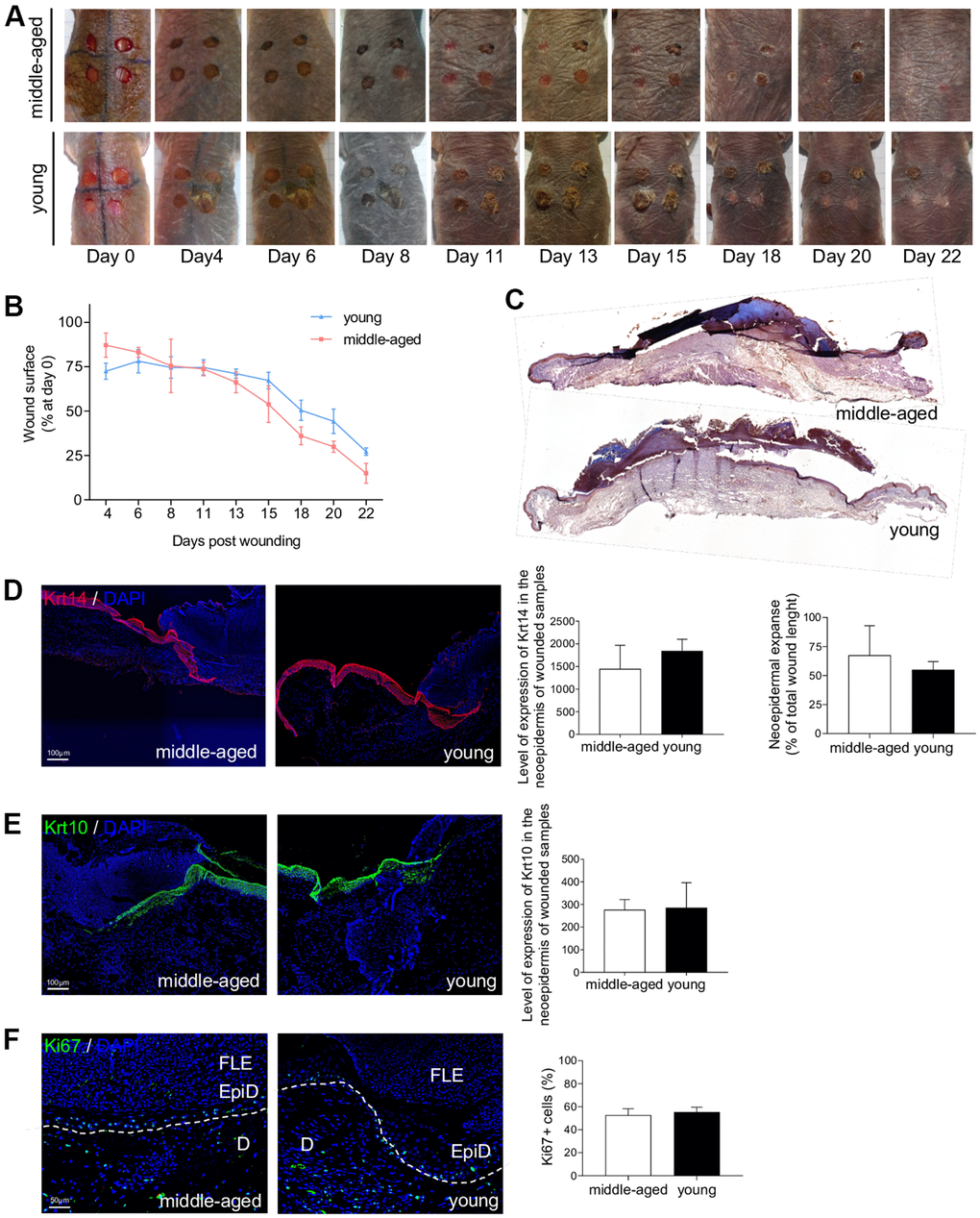NMR wound healing. (A) Photomicrographs of back skin wounds for middle-aged and young animals from day 0 to day 22 post wounding. (B) Wound closure rate (% of wound surface at day 0) from day 4 to day 22 post wounding. No statistical difference was found the 2 groups using Student’s t-test. n=4 animals per group. (C) HE staining photomicrographs on sections of middle-aged and young NMR back skin 7 days post wounding. (D, E) Krt14 and Krt10 staining photomicrographs on sections of middle-aged and young NMR neoepidermal tongues in the wound at day 7. Histograms show the level of expression of Keratin-14 and Keratin-10 in the neoepidermis of wounded samples (mean grey value per field) and the percentage of re-epithelialization was calculated according to the formula: [length of the extending epidermal tongues]/[length of the wound] x100%. (F) Ki67 staining photomicrographs on sections of middle-aged and young NMR neoepidermal tongues in the wound at day 7. Histogram show the percentage of Ki67+ cells in epidermal wound edges representing the growth fraction of an epidermal tongue cell population. Legends: epidermal wound edges (EpiD), dermis (D), fibrino-leukocyte exudate (FLE). In (D–F), cells were stained with either Alexa 546 or Alexa 488 fluorochromes. Negative controls were performed in parallel with the samples substituting the primary antibody with the equivalent isotype. Scale bar = 50 or 100 μm. Dash lines represent the limit between epidermis and dermis. Bars: SEM. Student’s t-test were used. n=2 animals per group.