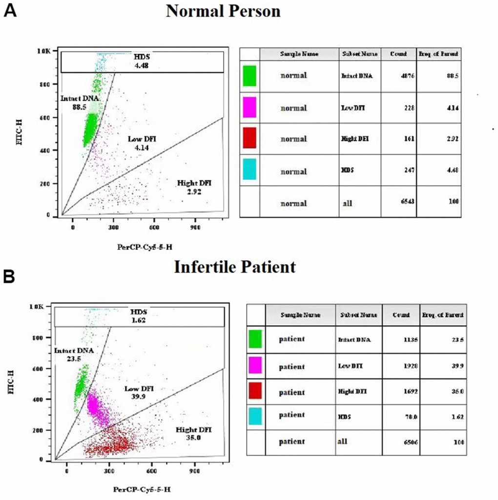 Representative results of sperm chromatin structure assay (SCSA) using flow cytometry. (A) SCSA parameters of a normal person. (B) SCSA parameters of an infertile patient.