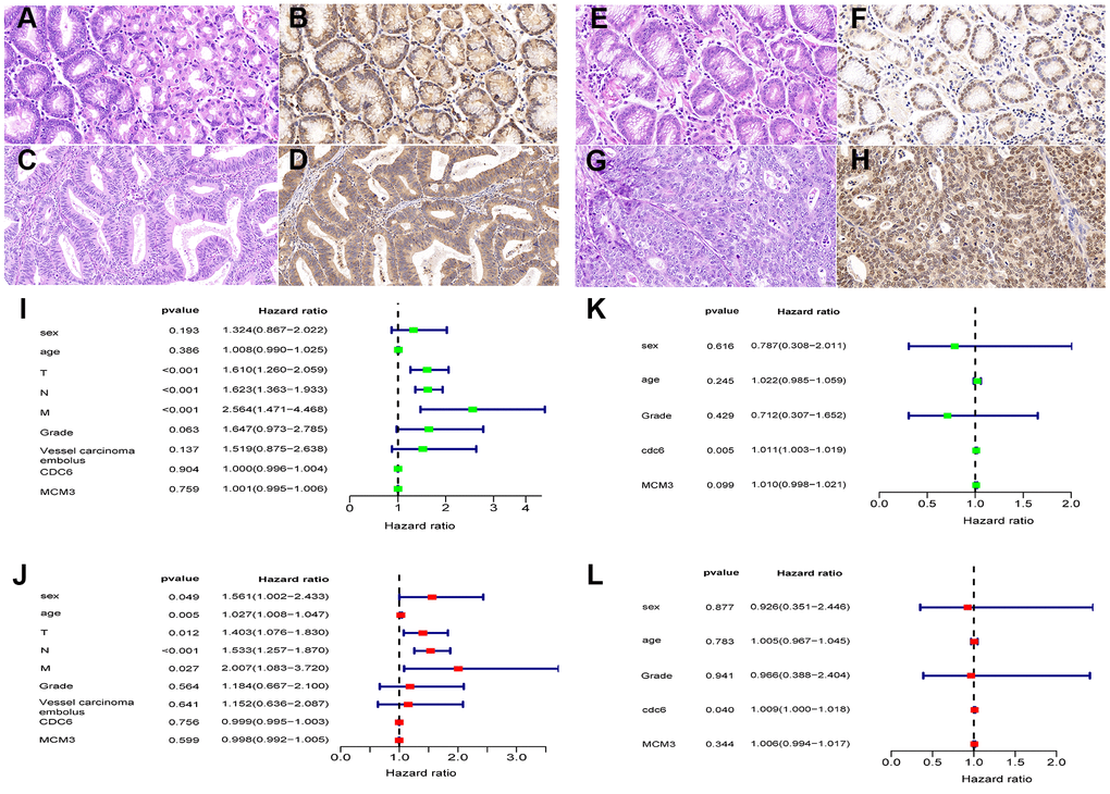 Protein expression levels of CDC6 and MCM3 in Chinese GC patients by immunohistochemistry (IHC). CDC6 significantly correlated with survival rates of GC patients with stratified analysis. HE-stained sections (A) and IHC staining of CDC6 in nontumor tissues: H-SCORE 181.1 (B); HE-stained sections (C) and IHC staining of CDC6 in tumor tissues: H-SCORE 169.8 (D); HE-stained sections (E) and IHC staining of MCM3 in nontumor tissues: H-SCORE 52.7 (F); HE-stained sections (G) and IHC staining of MCM3 in tumor tissues: H-SCORE 156.1 (H); Magnification: 400×. (I–L) Forrest plots of univariate and multivariate Cox regression analysis.