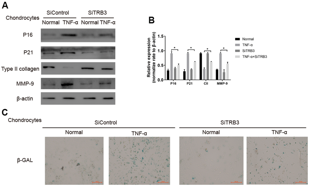 Chondrocyte senescent is dependent on TRB3. (A, B) Western blotting analyses of senescent markers p21, p16, type II collage and MMP-9 with β-actin as a loading control. (C) Representative graphs of cells stained for β-gal activity. The results are described as the mean ± SD. *P 