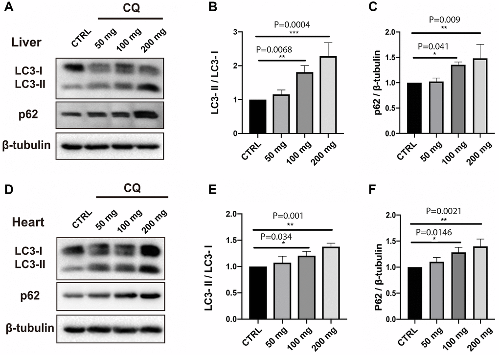 CQ treatment caused an increase in the LC3-II/LC3-I ratio and p62 levels in the liver and heart homogenates. In our toxicity study, there was a progressive, significant increase in the LC3-II/LC3-I ratio in the liver (A, B). The increase in the LC3-II/LC3-I ratio was paralleled by an increase in the expression level of p62 in the liver (C). The increase in the LC3-II/LC3-I ratio with increasing chloroquine concentration in drinking water was also significant, albeit less obvious in the heart homogenates (D, E). The increase in the LC3-II/LC3-I ratio was paralleled by an increase in the expression level of p62 in the heart (F) homogenates. Data are mean ± SD values. N = 5 for each group.