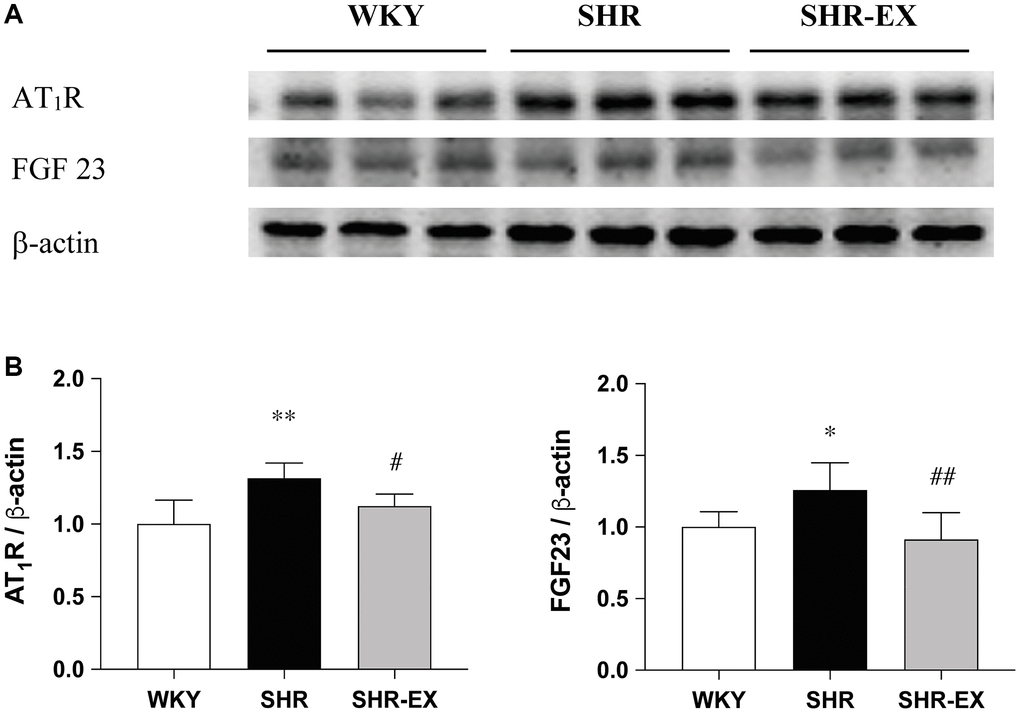 Effects of exercise training on the AT1R and FGF23. (A) The representative protein quantification of AT1R and FGF23 extracted from the left ventricles were measured by Western blotting analysis; (B) Bars represent the densitometric analysis of AT1R and FGF23. Data are expressed as the mean values ± SD (n = 8 in each group). *p **p #p ##p 