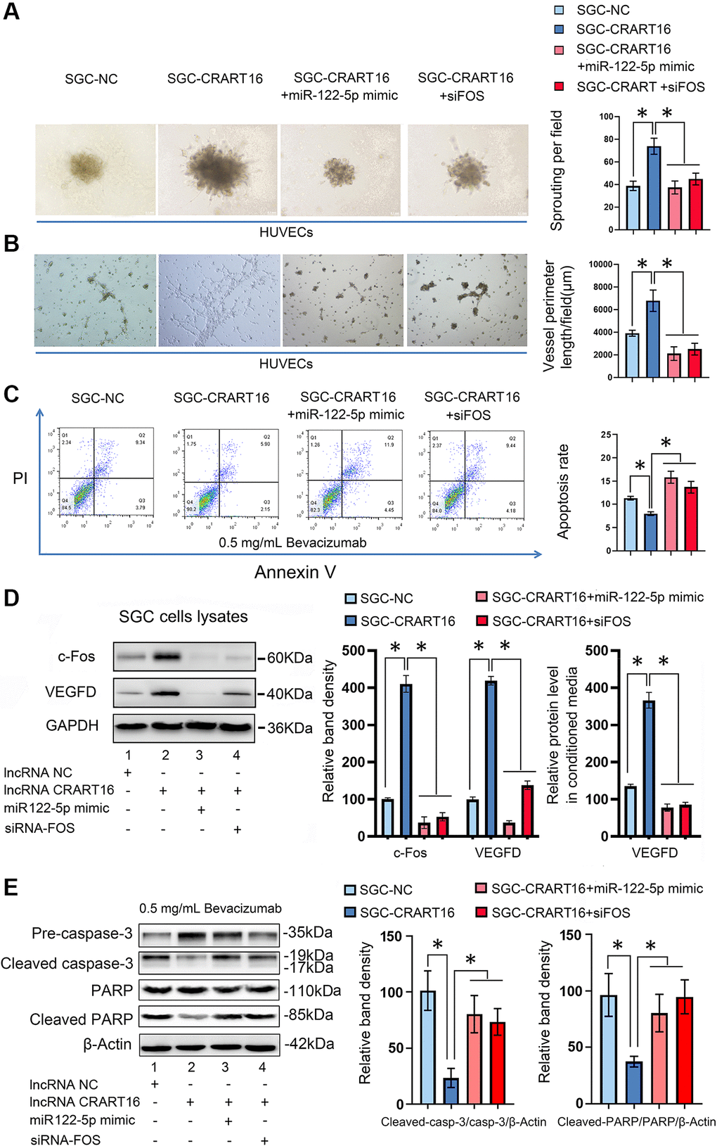 CRART16 promotes angiogenesis and bevacizumab resistance by regulating the miR-122-5p/c-Fos axis. (A) Effects of conditioned medium on spheroid sprouting of HUVECs (*P B) Effects of indicated conditioned medium on capillary formation by HUVECs (*P C) The apoptosis rate of indicated cells treated with bevacizumab for 48 hours (*P D) Levels of c-Fos and VEGFD were determined by western blotting. GAPDH served as a loading control (*P *P E) Based on western blotting, the relative expression levels of cleaved caspase-3 and cleaved PARP in indicated gastric cancer cells treated with bevacizumab for 48 hours. β-Actin served as a loading control (*P 