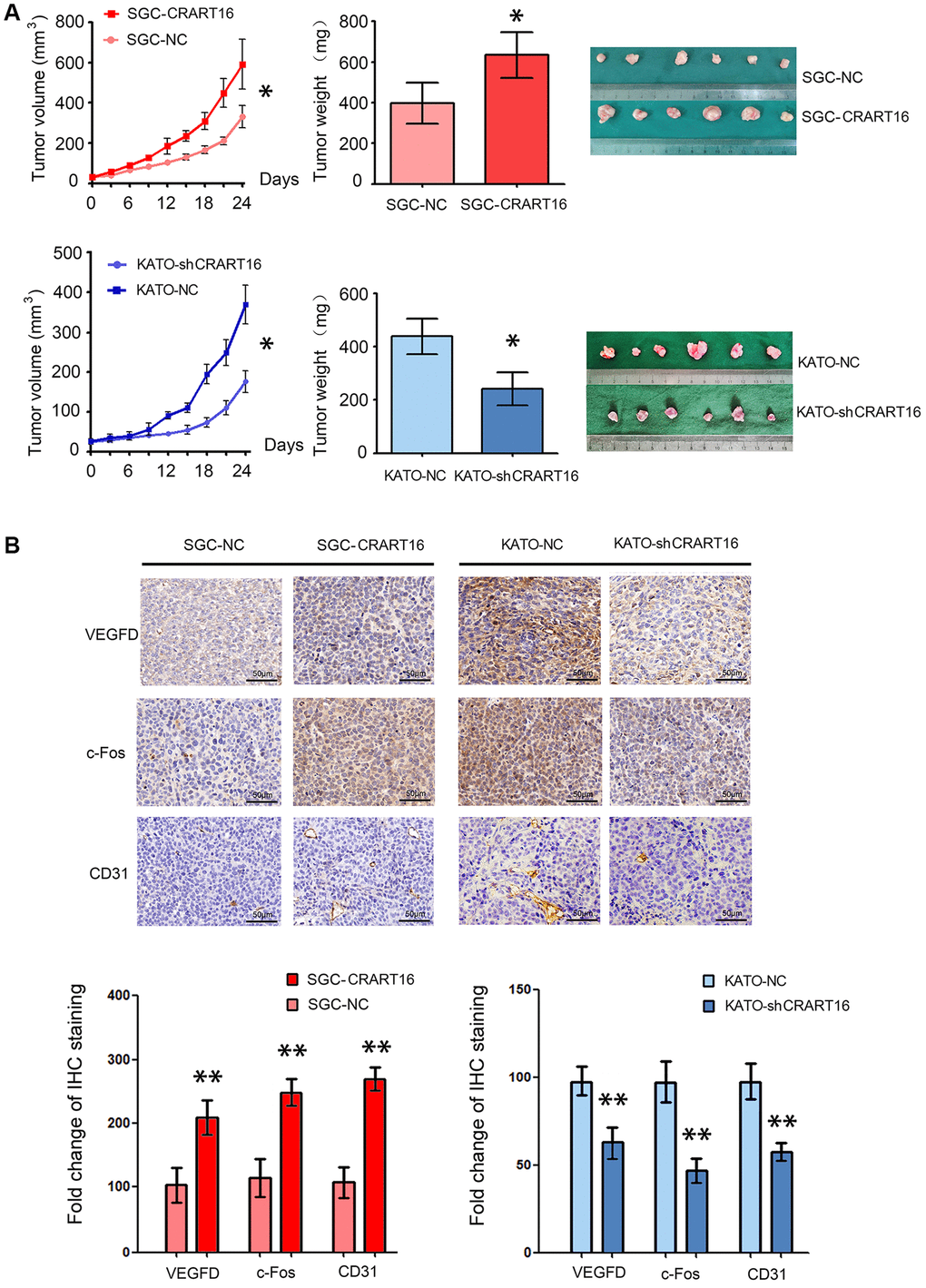 CRART16 overexpression in gastric cancer cells accelerates tumor growth and upregulates angiogenesis in nude mouse models. (A) Tumor volumes and tumor weights are illustrated as mean ± SD for six mice from different groups (*P B) Representative micrographs and quantitation of immunostaining against c-Fos, VEGFD, and CD31 in different tumor sections. All data are presented as mean ± SD of quintuplicate determinations of six mice from different groups (**P 