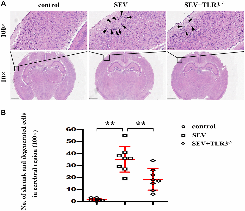 (A) Pathological changes (HE staining) in the cortical and hippocampal regions of neonatal mice (Magnification is 100× and 400×, respectively), (B) Statistical chart of pathological changes in cortical regions.