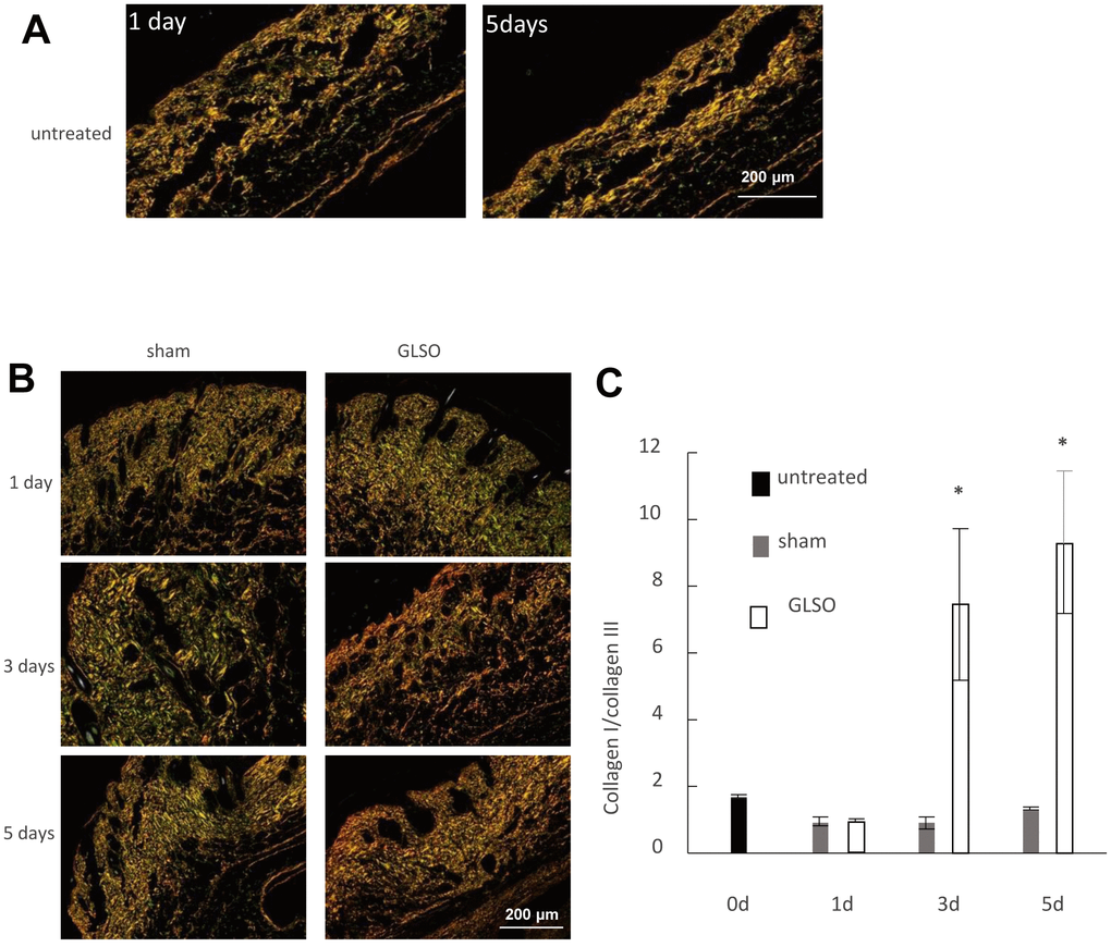 The effect of GLSO on the ratio of collagen I to collagen III in skin burn in mice. (A) Sirius Red staining of the sham mouse skin observed using a polarizing microscope. Scale bar=200 μm. (B) Sirius Red staining of the mouse skin treated with or without GLSO. Scale bar=200 μm. (C) Quantitative analysis of the ratio of collagen I to collagen III was performed (n=3 per group). The data are presented as the mean ± SD. *P