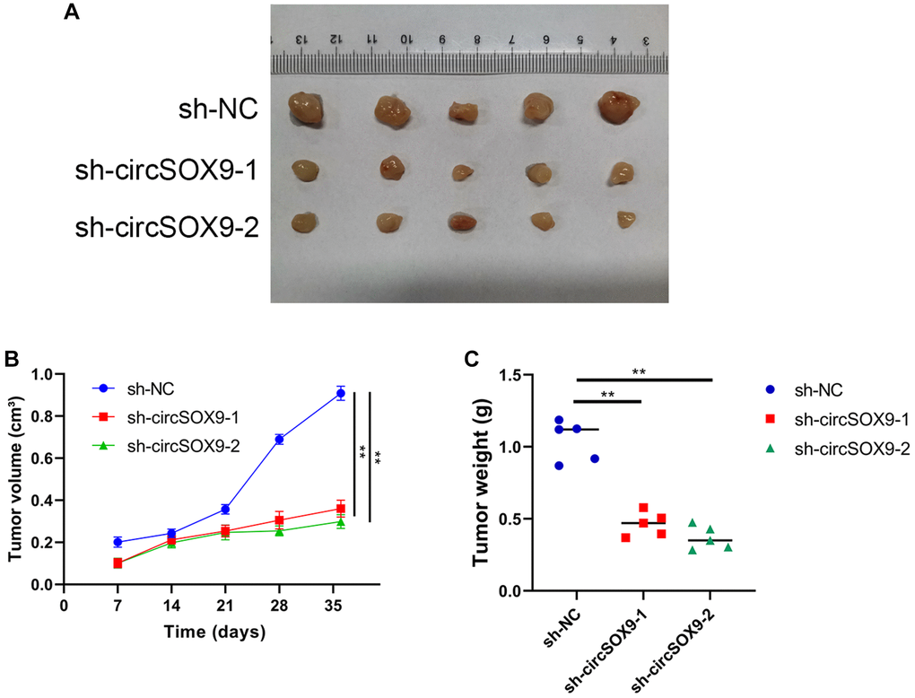 CircSOX9 promotes the proliferation of NPC cell in vivo. (A) Subcutaneous tumorigenesis experiments in nude mice were used to analyze the effect of circSOX9 on the proliferation ability of HONE1 cell. (B) Volume Growth Curve Analysis of Subcutaneous Tumors. (C) Weight analysis of subcutaneous tumors.*P 