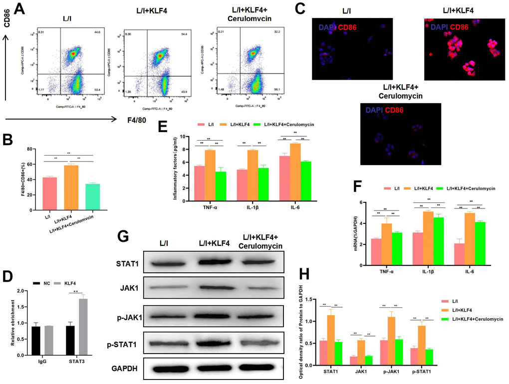 Effect of STAT1 inhibitor pretreatment on KLF4 overexpression. (A, B) The proportion of M1 cells was detected by flow cytometry (n=3): STAT1 inhibitor suppressed the M1 polarization of macrophages and decreased the cell proportion.**PC) IF staining of CD86 expression (n=3): STAT1 inhibitor suppressed CD86 expression and markedly decreased the fluorescence intensity. (D) RIP assay indicated the binding relation between KLF4 and STAT1. (E) Expression of M1 cell marker proteins (n=3, TNF-α, IL-6, IL-1β). After STAT1 inhibitor pretreatment, the expression of inflammatory factors TNF-α, IL-6 and IL-1β was down-regulated. **PF) Expression of mRNA (n=3, TNF-α, IL-6, IL-1β). After STAT1 inhibitor pretreatment, the expression of mRNA was down-regulated. **PG, H) Expression of JAK1-STAT1 signal proteins (n=3). After STAT1 inhibitor pretreatment, the expression of JAK1 and STAT1 proteins decreased, and their phosphorylation levels were down-regulated. **P