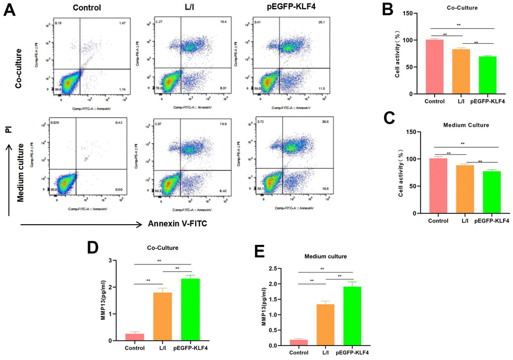 Effect of M1 macrophages on chondrocyte injury. (A) Flow cytometry (n=3): Chondrocytes co-cultured with M1 macrophages and those cultured with culture medium exhibited obvious apoptosis, macrophages with KLF4 overexpression induced more severe chondrocyte apoptosis than ordinary macrophages, and the apoptosis rate was up-regulated. (B, C) Cell viability detection (n=3) results suggested that, cells in Control group did not show obvious apoptosis, while chondrocytes co-cultured with M1 macrophage/cultured with culture medium had markedly decreased viability. **PD, E) Expression of MMP13 (n=3). The expression level of MMP13 in Control was lower, while in L/I, both co-culture and medium could increase the expression of MMP13 in chondrocytes, After KLF4 overexpression, the level of MMP13 was further increased, with a significant difference compared with L/I, **P