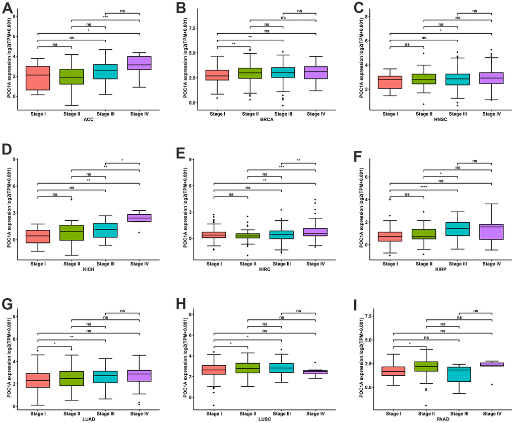 POC1A expression at various stages of tumor. (A–I) Expression of POC1A at various stages of tumor in indicated tumors. *P