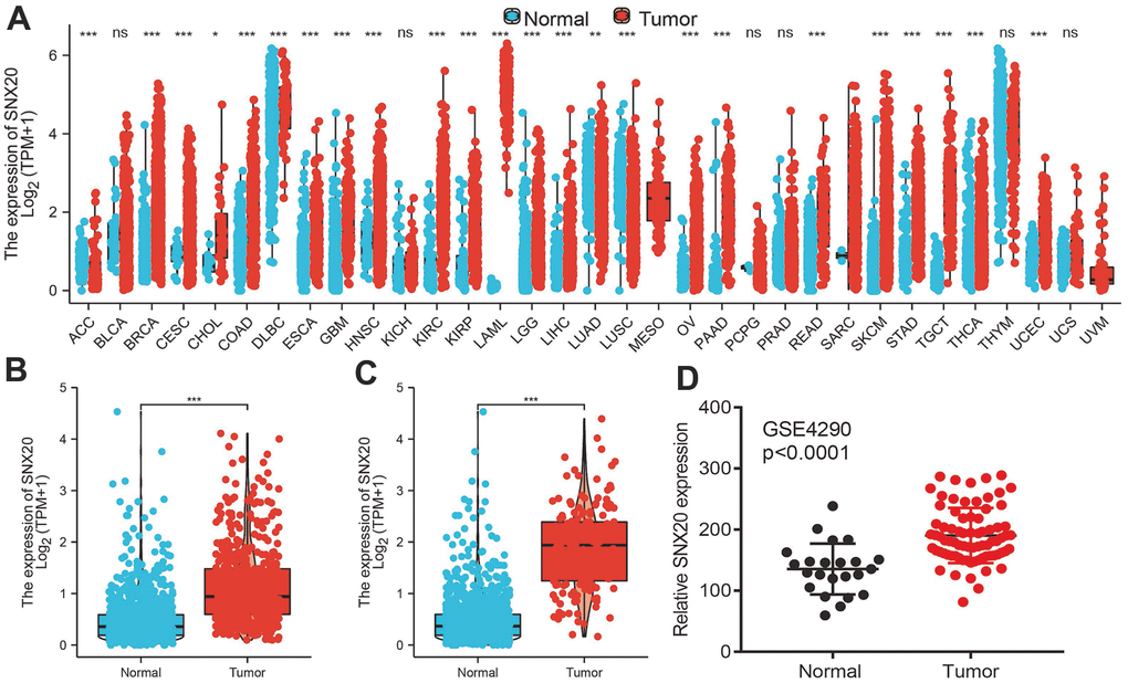 SNX20 is highly expressed in LGG. (A) The expression of SNX20 in pan-cancer examined by TCGA database. (B–D) The expression of SNX20 in LGG examine by TCGA/GEO databases.