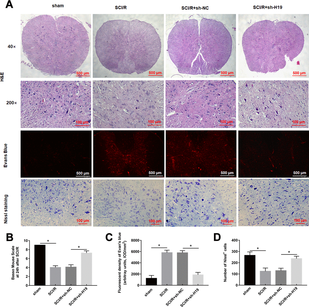 Downregulation of H19 alleviates SCI/R injury in SCI/R mice. (A) H&E, Evans Blue Extravasation, and Nissl staining (× 200) were investigated in mice after SCI/R for 48 h. (B) The locomotor function of the hind limbs was investigated by the BMS score in mice after SCI/R for 48 h. EB (C) and Nissl positive cells (D) were analyzed quantitatively, respectively. The results were presented as the mean ± SD. N = 10; *P