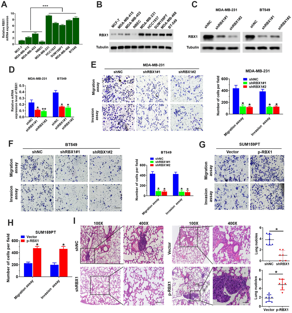 RBX1 facilitated the cell invasion and migration of TNBC in vivo and in vitro. (A, B) RBX1 mRNA and protein levels in normal breast epithelial, TNBC, and non-TNBC cell lines. ***PC, D) The analysis of qRT-PCR and western blot were applied for determining the RBX1 expression levels of in BT549 and MDA-MB-231 cells stably transfected with the plasmid silenced by RBX1. *P **P E, F) The assays of Transwell invasion and migration of BT549 and MDA-MB-231 cells transfected by the plasmid with knockdown of RBX1. *P **P G, H) The assays of Transwell invasion and migration of SUM159PT cells transfected by plasmid with overexpression of RBX1. *P **P I) H&E staining of sections embedded with paraffin of metastatic nodules in the lungs. *P 