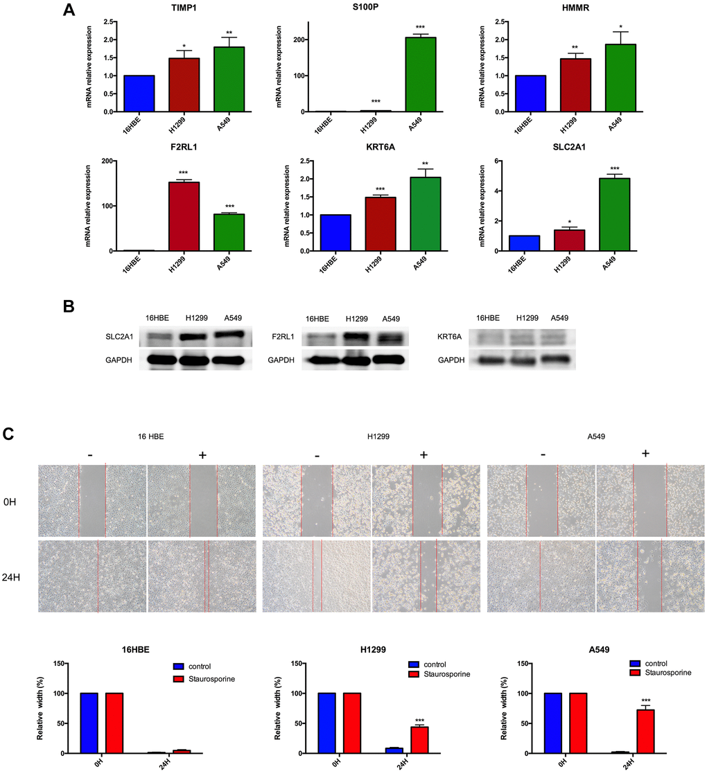 Experimental verification. (A) Results of TIMP1, S100P, HMMR, F2RL1, KRT6A, and SLC2A1 mRNA expression in A549, H1299 and 16HBE by RT-PCR. (B) Results of F2RL1, KRT6A, and SLC2A1 protein expression in A549, H1299 and 16HBE by western blot. (C) Staurosporine could inhibit cell migration in A549 and H1299 cells. *p **p ***p 