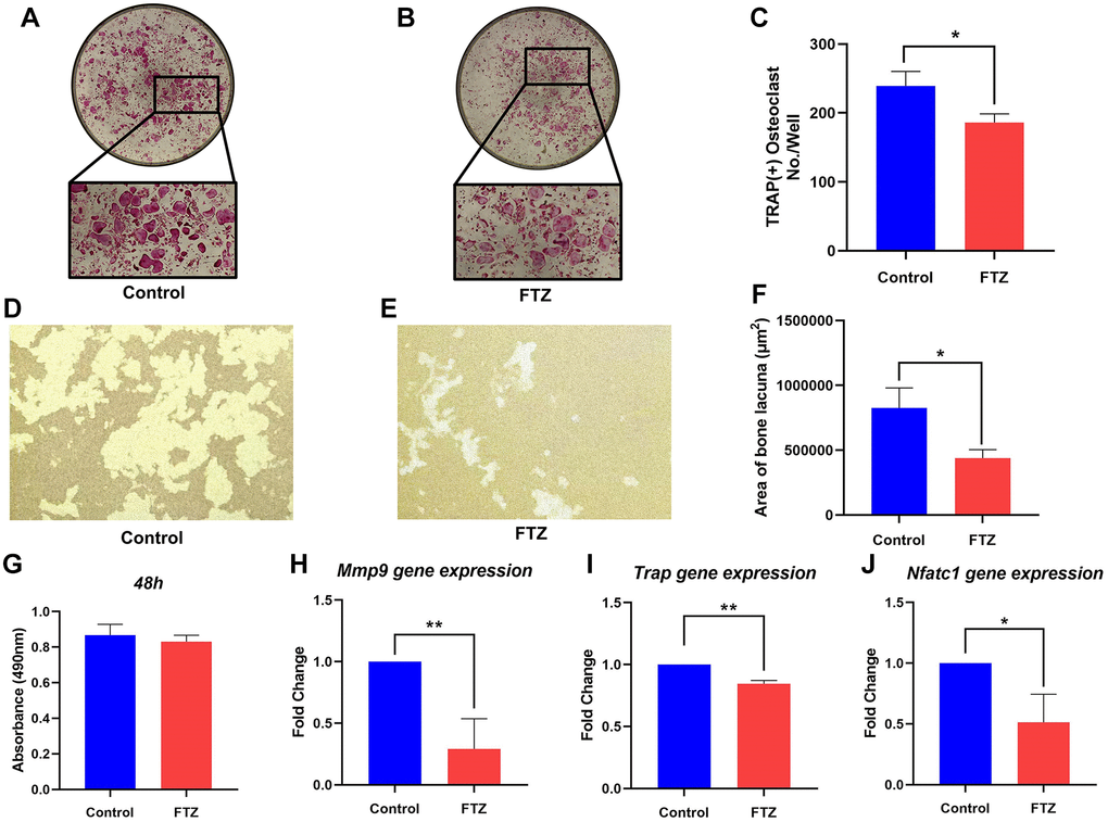 FTZ suppresses the function of osteoclasts and osteoclast-specific genes expression. (A and B) TRAP staining for osteoclast stimulated by RANKL (Control) and incubated with FTZ-containing serum (FTZ), respectively. (C) The number of the TRAP-stained osteoclasts (>3 nuclei) was calculated. (D and E) Representative images of eroded areas on hydroxyapatite-coated plates under RANKL or FTZ treatments (magnification = 10×). (F) Quantitative analysis of pit area with or with FTZ treatment. (G) BMMs were treated with FTZ for 48 h and the MTS assay was used to measure cell viability. (H–J) Determination of key mRNA expression during osteoclast differentiation by RT-qPCR, including Mmp9, Trap, Nfatc1 (n = 3). *p **p 