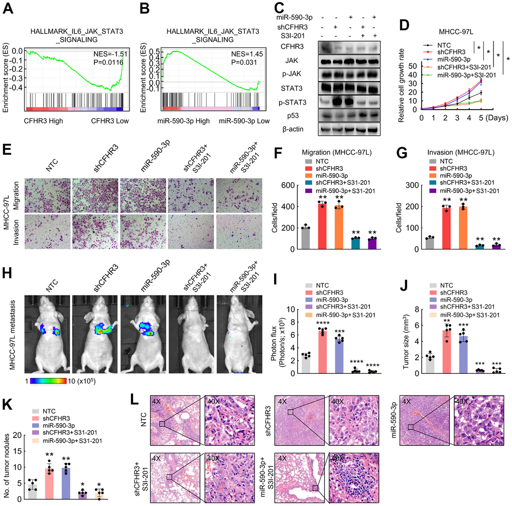 CFHR3 downregulation promotes phosphorylation of STAT3 and (A, B) GSEA plots show the enrichment of genes in response to JAK/STAT3 signaling between the HCC tissues with CFHR3high and CFHR3low (A), or between the HCC tissues with miR-590-3phigh and miR-590-3plow (B). (C–G) MHCC-97L cells transfected with shCFHR3-RNAs or miR-590-3p precursor were treated with S3I-201 (50μM) or DMSO (control) for 8 hours, and the indicated protein levels (C), cell growth (D), migration and invasion (E–G) were investigated. (H, I) The indicated luciferase-labeled MHCC-97L cells (2 × 106 cells/mouse) were injected into NOD-SCID mice (H); the luciferase activity was visualized 6 weeks post-transplantation (I, n = 5) (J, K) The tumor size (J) and number (K) of metastatic tumor nodules in mouse lung were observed and shown in a bar chart, respectively. (L) Representative IHC images of mouse metastatic tumors formed by MHCC-97L cells. (Remarks: * represents P 