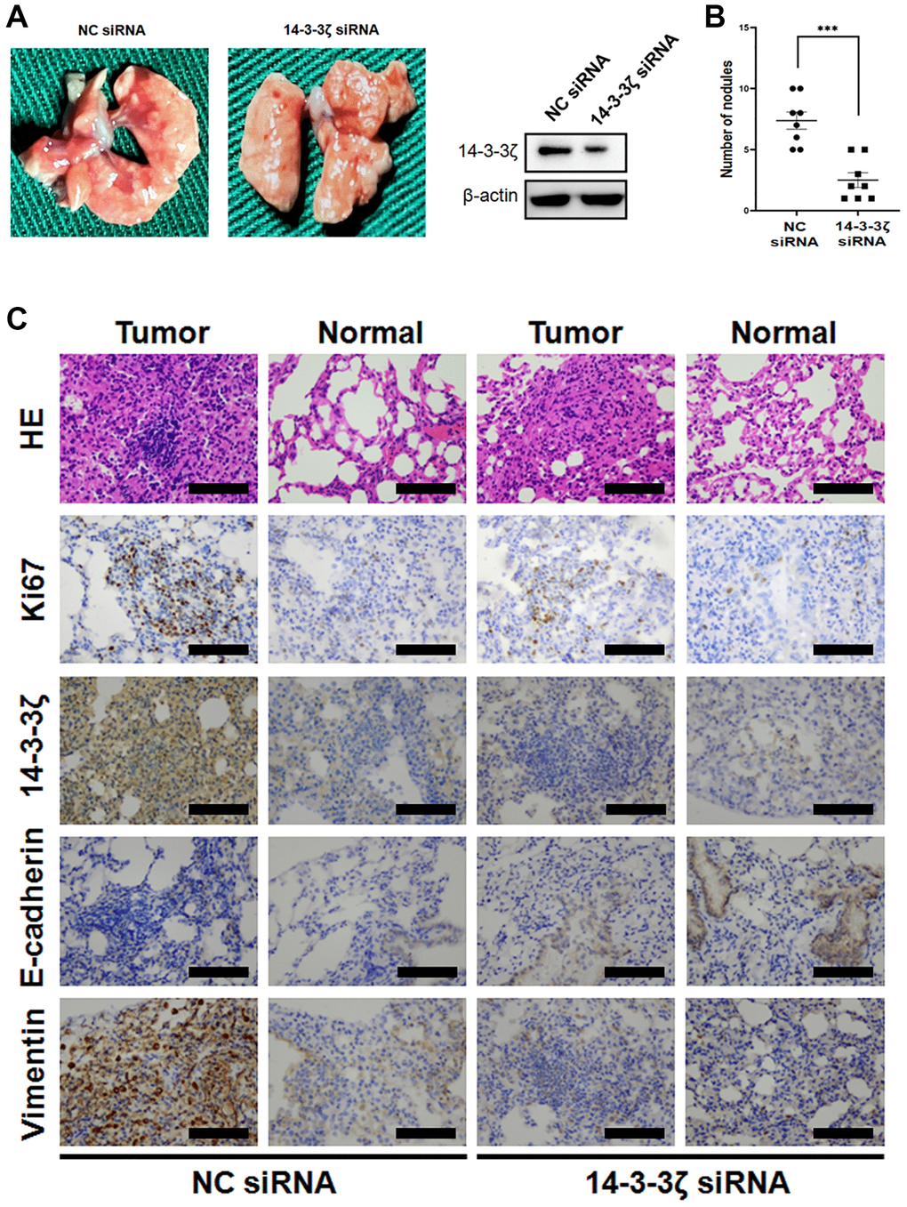 Overexpression of 14-3-3ζ accelerates LLC cell lung metastasis in vivo. (A and B) The LLC cells were transfected with siRNA targeting 14-3-3ζ or negative control. After indicated treatment, cells were injected into C57BL/6J mice through the medial tail vein. At the end of experiment, mouse lungs were carefully isolated and metastatic lung nodules were calculated. (C) Representative histological and IHC images of mouse lungs after LLC cells tail vein injection. The metastatic LLC nodules and adjacent normal lungs were evaluated for Ki67, 14-3-3ζ, E-cadherin and vimentin expression. Scale bar = 200 μm.