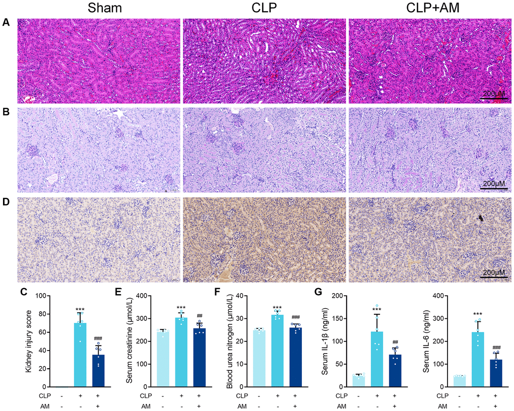 Astragalus membranaceus protects against renal injury in CLP-induced sepsis. (A) Representative images of H&E staining of kidney sections obtained at 24 hours after CLP surgery following treatment with (250 mg/kg) Astragalus membranaceus. (B) Representative images of periodic acid Schiff’s staining reagent depicting basement membrane and brush border in kidney sections. (C) Semiquantitative analysis of tubular injury. (D) Representative images showing KIM-1 immunohistochemical staining results in kidney tissues. Serum creatinine (E) and Blood urea nitrogen (F) in mice were measured. (G) Serum IL-6 and IL-1β concentrations were measured by ELISA. Data are presented as the mean ± SEM (n = 6 per group, ***P ##P ###P 