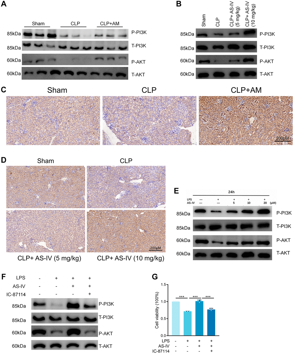 Astragalus and AS-IV enhanced PI3K/AKT pathway in vivo and vitro. (A and B) Expression level of Phospho-PI3K, PI3K, Phospho-AKT and AKT in kidney sections collected at 24 hours after CLP surgery following treatment with (250 mg/kg) Astragalus membranaceus or low (5 mg/kg) or high dosage (10 mg/kg) AS-IV. (C and D) Representative images showing Phospho-AKT immunohistochemical staining of mice kidney tissues. (E) Expression level of Phospho-PI3K, PI3K, Phospho-AKT and AKT in HK-2 cells incubated with LPS (1 μg/ml) plus AS-IV at the concentrations of 5, 10, 20 μM for 6 hours. (F) Protein expression of Phospho-PI3K, PI3K, Phospho-AKT and AKT in HK-2 cells incubated with LPS (1 μg/ml) plus AS-IV (20 μM) or PI3K inhibitor IC-87114 (5 μM) for 6 hours. (G) MTT results for AS-IV (20 μM) or PI3K inhibitor IC-87114 (5 μM) treatment on HK-2 cells incubated with LPS (1 μg/ml) for 6 hours. Data are presented as the mean ± SEM (n = 3 per group, *P **P ***P 