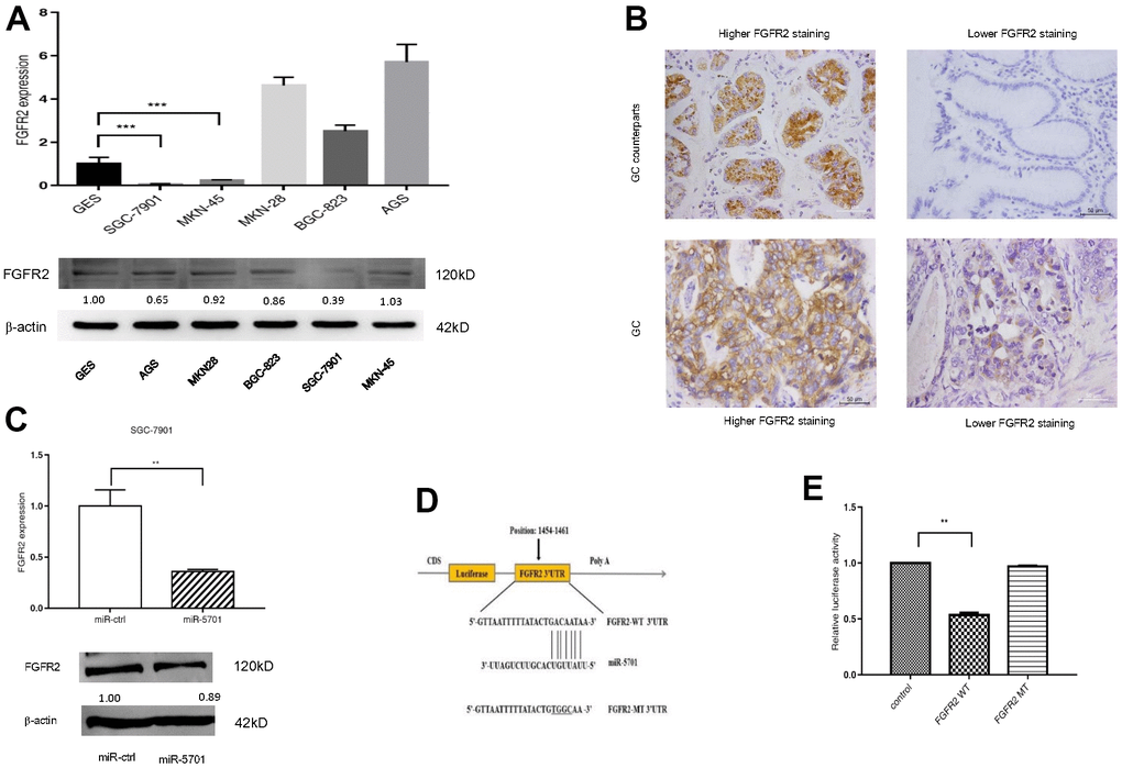 FGFR2 is a direct target of miR-5701. (A) The mRNA levels and protein levels in GC cell lines by qRT-PCR and Western blot. (B) Representative images of FGFR2 in GC tissues by immunohistochemistry. (C) mRNA level and protein level of FGFR2 after miR-5701 overexpression in SGC-7901. (D) miR-5701 is highly conserved across species and has binding sites within the 3′-UTR of human FGFR2; (E) Relative luciferase activity was measured to assess the target relationship of miR-5701 to FGFR2. Data are represented as the mean±SD and experiments were performed in triplicate; * p