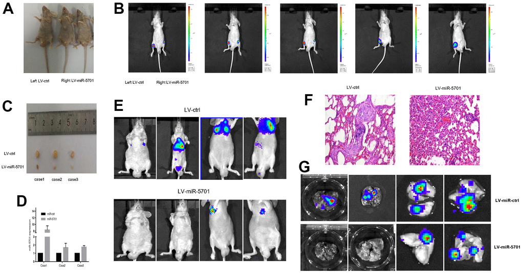 miR-5701 inhibited GC proliferation and metastasis in vivo. (A) SGC-7901 cells were infected with LV-miR-5701 or LV-ctrl and inoculated into groin subcutaneous tissue of nude mice, left for LV-ctrl, right for LV-miR-5701. (B) Tumors were measured by in vivo bioluminescence image. (C) Mice were sacrificed and tumors were isolated. (D) miR-5701 expressions in tumors were detected by qRT-PCR. (E–G) SGC-7901 cells were infected with LV-miR-5701 or LV-ctrl and injected into tail vein of nude mice, tumor metastasis in lung was detected by HE staining and by in vivo bioluminescence imaging.