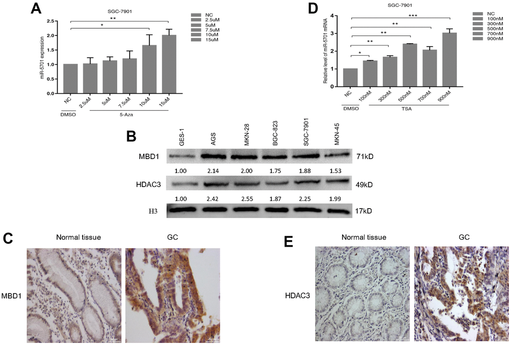 miR-5701 expression was regulated by MBD1 and HDAC3. (A) SGC-7901 cells were treated with 5-Aza at different concentration and miR-5701 expression was measured by qRT-PCR. (B) MBD/HDAC3 levels of several GC cell lines were measured by western blot. (C) The representative images of MBD1 in GC tissue versus normal tissue by immunohistochemistry. (D) SGC-7901 cells were treated with TSA at different concentration and miR-5701 expression was measured by qRT-PCR. (E) The representative images of HDAC3 in GC tissue versus normal tissue by immunohistochemistry.