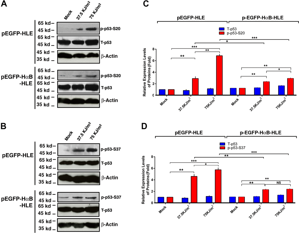 αB-crystallin inhibited p53 hyperphosphorylation under UVA irradiation. Both pEGFP-HLE and pEGFP-HαB-HLE cells (Mao et al., 2004) were grown to 90% confluence, then subjected to mock irradiation, 37.5 KJ/m2 and 75 KJ/m2 UVA irradiation, respectively. The irradiated cells were harvested for extraction of total proteins which were used for analysis of total p53 (T-p53) (A, B), phosphorylated p53 at S-20 (p-p53-S20) (A) and phosphorylated p53 at S-37 (p-p53-S37) (B) by Western blot analysis. Quantitative results of the T-p53, p-p53-S20 (C) and p-p53-S37 (D) levels were analyzed by Image J software. Note that UVA-induced much stronger p53 activity (phosphorylation at S-20 and S-37) in pEGFP-HLE cells than that in pEGFP-HαB-HLE cells. N=3. NS, not significant; *ppp