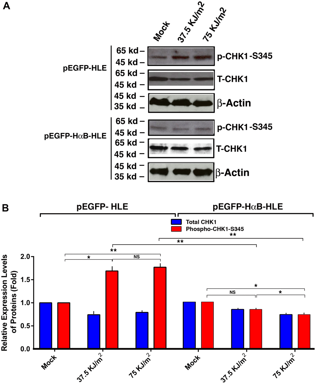 αB-crystallin inhibited CHK1 activation under the UVA irradiation. Both pEGFP-HLE and pEGFP-HαB-HLE cells (Mao et al., 2004) were grown to 90% confluence, then subjected to mock irradiation, 37.5 KJ/m2 and 75 KJ/m2 UVA irradiation, respectively. The irradiated cells were harvested for extraction of total proteins which were used for analysis of total CHK1 (T-CHK1, 54 kd), phosphorylated CHK1 at S-345 and β-Actin (loading control) levels (A) by Western blot analysis. Quantitative results of the T-CHK1 and p-CHK1-S345 against β-actin (loading control) levels in pEGFP-HLE cells and pEGFP-HαB-HLE cells (B) were analyzed by Image J software. Note that UVA induced significant upregulation of CHK1 activity (as reflected by phosphorylation at S345) in pEGFP-HLE cells. In contrast, in pEGFP-HαB-HLE cells, both total CHK1 and phosphorylated CHK1 at S345 were downregulated under UVA irradiation. N=3. NS, not significant. *pp