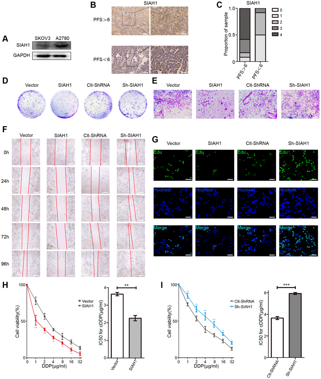 SIAH1 sensitizes ovarian cancer cells to cDDP. (A) Western blotting for SIAH1 in SKOV3 and A2780 cells. (B) Representative images of immunohistochemical staining for SIAH1 in tumour specimens from ovarian cancer patients with PFS > 6 months vs. PFS C) Staining was assessed and scored on a scale of 0 (75% staining). The quantification of IHC staining (n = 24; PFS > 6, n = 12; PFS n = 12) was shown. The results from a Cell Colony formation assay (D) and Transwell assay (E) of A2780 cells transfected with Vector, SIAH1, Clt-shRNA and sh-SIAH1 were shown. Scale bar: 400 μm. A wound-healing assay was used to assess the effects of SIAH1 on cellular motility over time as shown (0, 24, 48, 72 and 96 h; Scale bar: 400 μm) (F). The results from a Cell Edu assay (Scale bar: 200 μm) (G), Cell Viability (H, I left panels) and IC50 for cDDP (H, I right panels) in A2780 cells were shown.*p **p ***p 