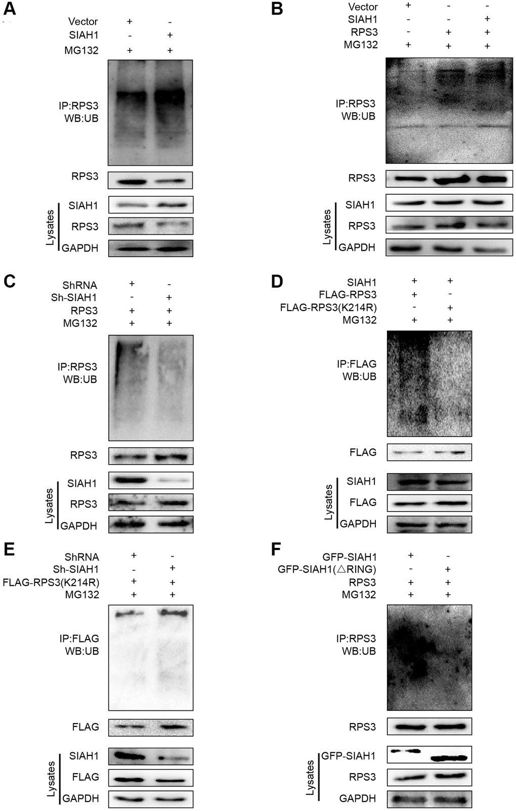 SIAH1 is an E3 ligase to induce RPS3 ubiquitination. (A–F) HEK293T cells were transfected plasmids as indicated for 36 h. Cell lysates were subjected to denatured immunoprecipitation and Western blotting. Cells were treated with MG132 (10 μM) for 6 h before cell lysis. (A) SIAH1 overexpression induced ubiquitination and degradation of endogenous RPS3. (B) SIAH1 overexpression induced ubiquitination and degradation of exogenous RPS3. (C) When SIAH1 was knocked down, the ubiquitination level of RPS3 was significantly reduced. (D) Upon SIAH1 expression, FLAG-RPS3 (K214R) had a significantly lower ubiquitination than the wild type (FLAG-RPS3). (E) SIAH1 KD, induced no significant decrease in the ubiquitination level of FLAG-RPS3 (K214R). (F) In SIAH1-inhibited A2780 cells, mutation of the RING finger domain of SIAH1 significantly reduced the ubiquitination level of RPS3.