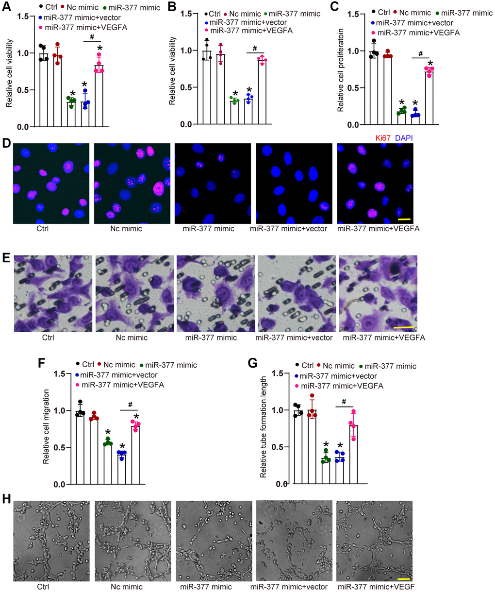 cMAP4K2-miR-377-VEGFA signaling axis regulates endothelial angiogenic effects. (A–F) HRVECs were treated as shown for 24 h. MTT assays and CCK-8 assays were performed to detect cell viability (A and B, n = 4). Ki67 staining assays were performed to detect cell proliferation. A representative image along with the quantification result were shown. Scale bar: 20 μm (C and D, n = 4). Transwell assay was performed to detect the migratory ability of HRVECs. A representative image and the quantification result were shown. Scale bar: 20 μm (E and F, n = 4). The tube-like structures were observed at 6 h after seeding HRVECs on the Matrigel matrix. The cumulative tube lengths for each field were analyzed. Scale bar: 100 μm (G and H, n = 4). *P #P 