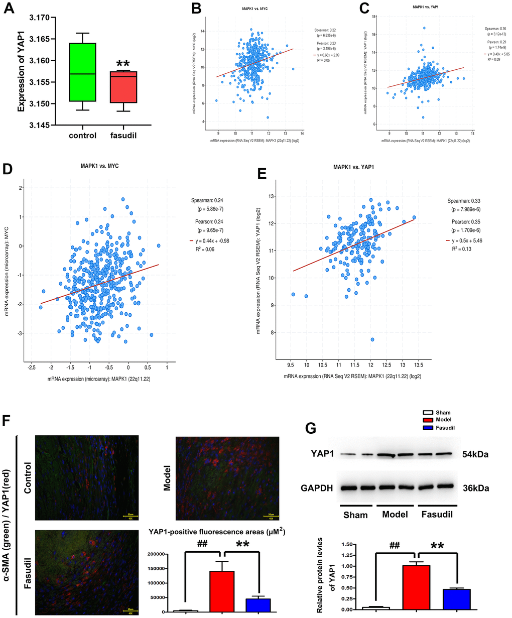 Fasudil repressed the YAP1 signaling pathway in arterial smooth muscle tissues of rabbits. (A) GSE60887 dataset downloaded from the GEO database. The microarray analysis revealed that MAPK1 expression declined in Fasudil group compared with that in Sham group. Pvs. Sham group. (B, C) Decreased MYC and YAP1 expressions in Fasudil group in comparison with those in Sham group. Pvs. Sham group. (D, E) Co-expression analysis revealed that MAPK1 was correlated with YAP1 and MYC. (F) Immunofluorescence staining for YAP1 andα-SMA. Compared with that in Model group and Sham group, the YAP1-positive fluorescence area was significantly decreased after Fasudil treatment. Pvs. Sham group. (G) Western blotting demonstrated that YAP1 protein expression level was decreased in Fasudil group in contrast with that in Model group. Pvs. Model group.