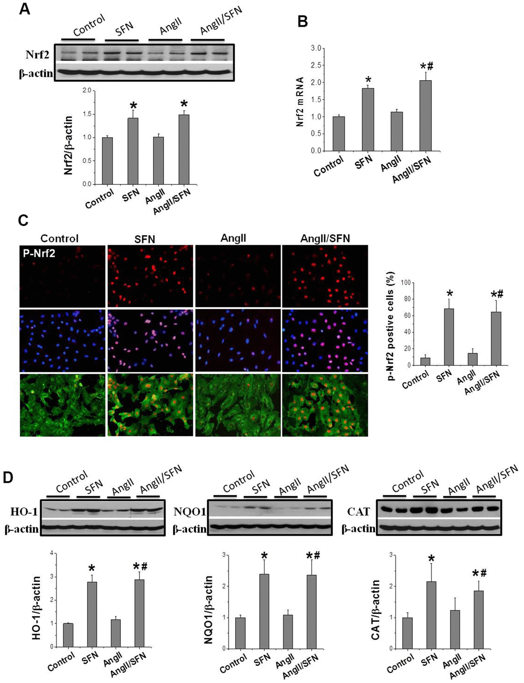 SFN up-regulates Nrf2 expression and function. Western blot (A), RT-qPCR (B) were used to detect Nrf2 protein and mRNA levels. Immunofluorescence staining was applied to detect p-Nrf2 expression and distribution (red) (C). Western blot was used to detect the expression of Nrf2 downstream antioxidant genes HO-1, NQO1, CAT (D). Data were presented as the mean SD (n = 3). *P P 