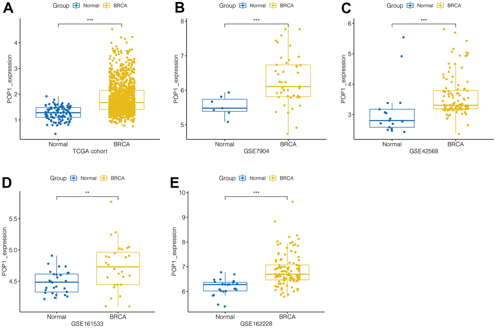 POP1 expression in BC. POP1 expression between non-BC tissues and BC tissues based on The Cancer Genome Atlas (TCGA) and Gene Expression Omnibus (GEO) datasets. (A) TCGA cohort. (B) GSE7904. (C) GSE42568. (D) GSE61533. (E) GSE162228. ** P 