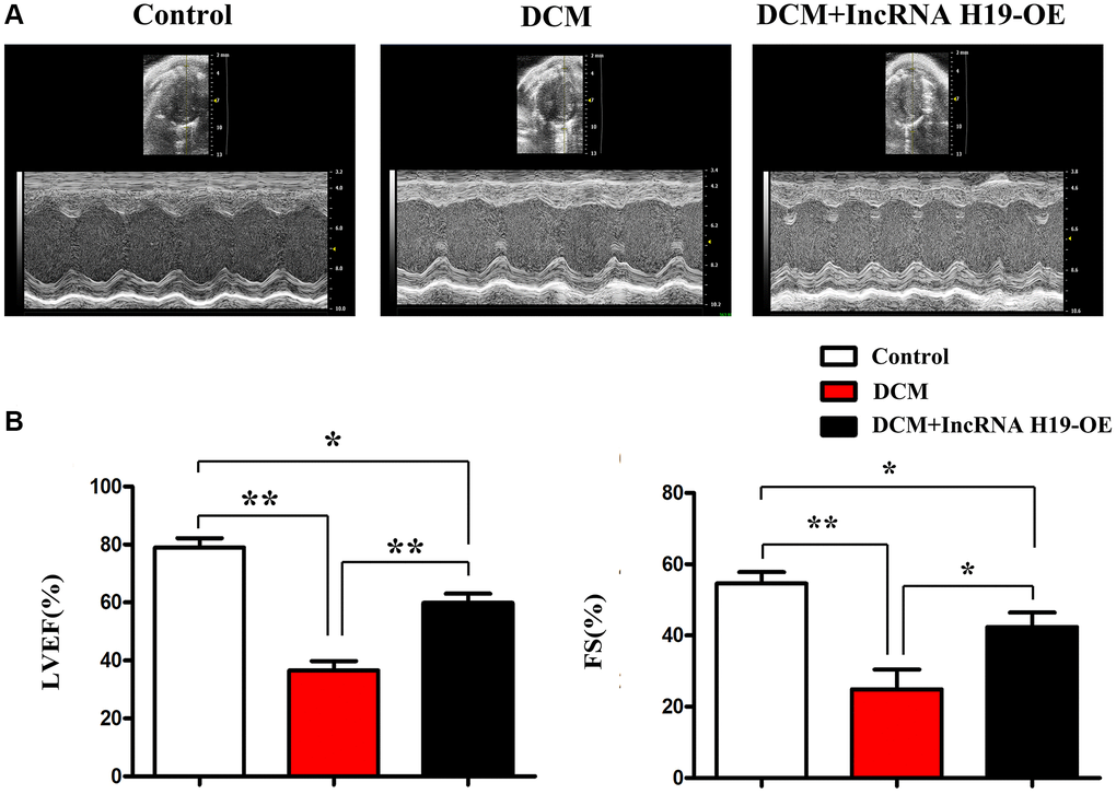 H19 improved left ventricular dysfunction. (A) Representative M-mode echocardiographic images. (B) LVEF and LVFS. Data are expressed as mean ± SEM. ∗P n = 6/group.