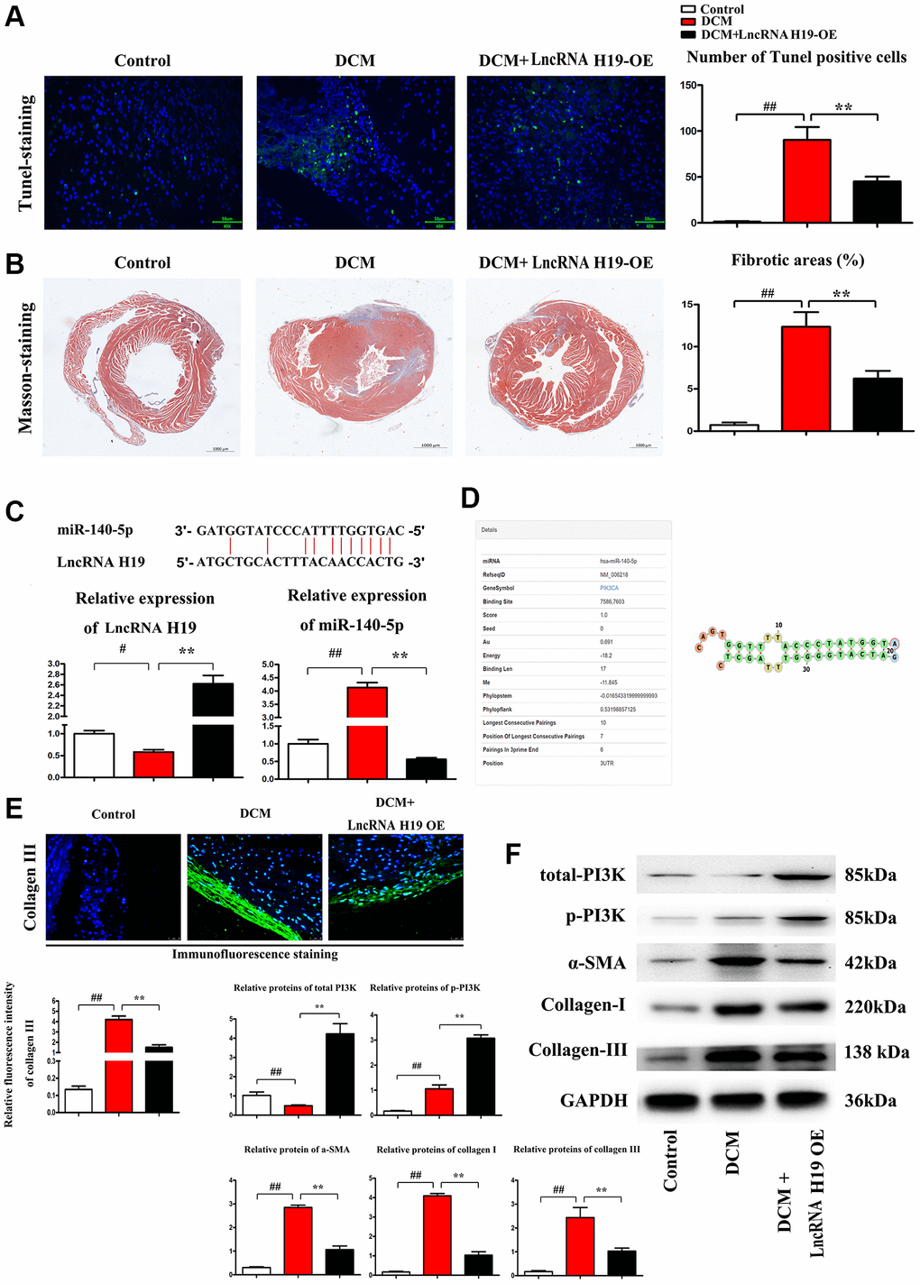 H19 reduced cardiomyocyte apoptosis and cardiac fibrosis in DM. (A) TUNEL staining was used to examine the apoptosis of cardiomyocytes. (B) Masson's trichrome staining was used to investigate the involvement of H19 in cardiac fibrosis in myocardial tissue. (C) The binding site of lncRNA H19 and miR-140-5p and relative expression of lncRNA H19 and miR-140-5p levels were determined by Q-PCR in each group. (D) Binding site of mir-140-5p to PIK3CA. (E) Immunofluorescence intensity of collagen III in each group. (F) The protein levels of p-PI3K, t-PI3K, a-SMA, and collagen-I/III in each group. #P ##P *P **P 