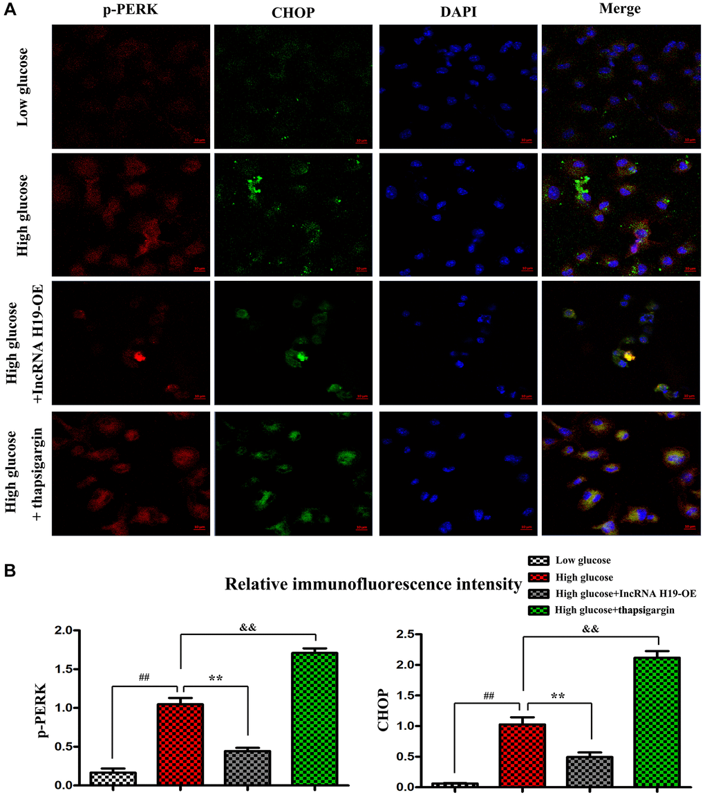 H19 repressed ERS in vitro. (A) Immunofluorescence staining exposed the expression of p-PERK and CHOP in four cell groups. (B) The statistical results of relative fluorescence intensity demonstrated the protein expression of p-PERK and CHOP in four cell groups. ##P **P &&P n = 3/group.