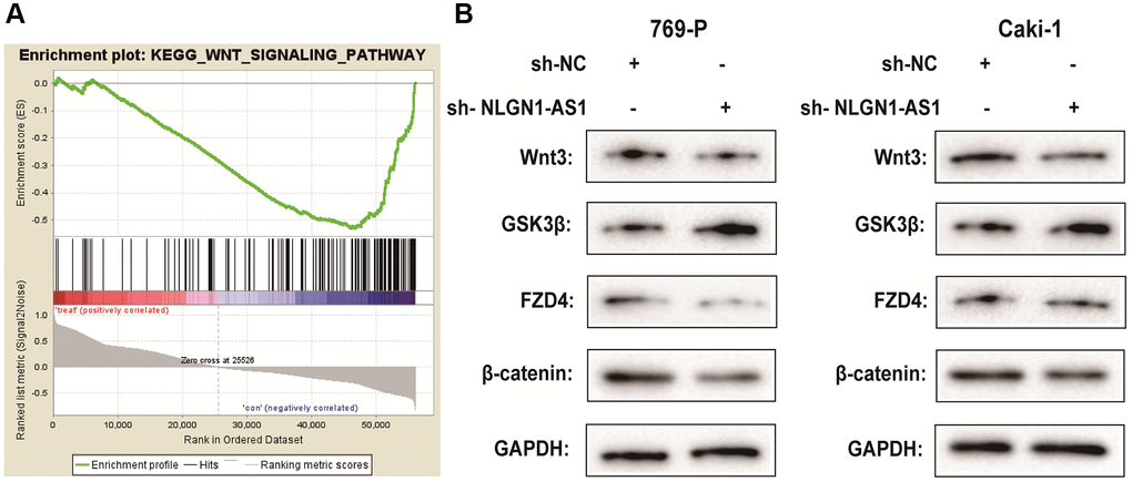 NLGN1-AS1 is associated with the activity of the Wnt/β-catenin pathway and suppressed the expression of FZD4. (A) Kyoto Encyclopedia of Genes and Genomes analysis revealed that the Wnt signaling pathway was significantly altered in ccRCC. (B) The effect of NLGN1-AS1 on the Wnt/β-catenin signaling pathway was analyzed by western blotting with the indicated antibodies and samples from the 769-P and Caki-1 cells transfected with sh-NLGN1-AS1 or sh-NC. The data represent the mean ± SD of 3 replicates. *P **P 